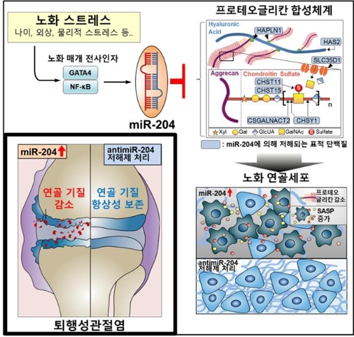 노화로 인한 퇴행성관절염 발병 과정