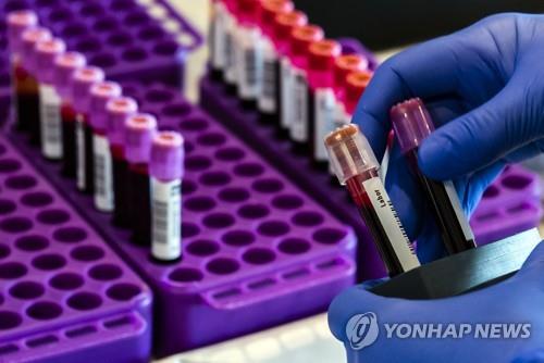 혈액검사