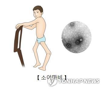 소아마비에 걸린 어린이