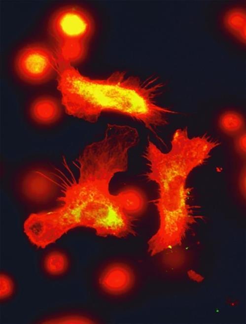 조혈모세포의 현미경 이미지