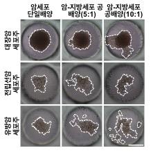 지방세포에 의한 암세포 이동