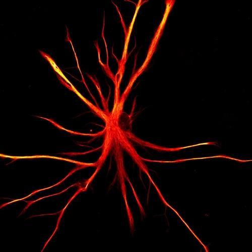 인간의 유도만능줄기세포(iPSCs)에서 유래한 성상교세포