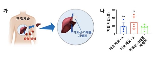 간 절제 환자 대상 지혈 효과 임상시험
