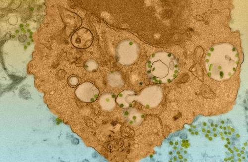 Novel coronavirus that infects lung macrophages